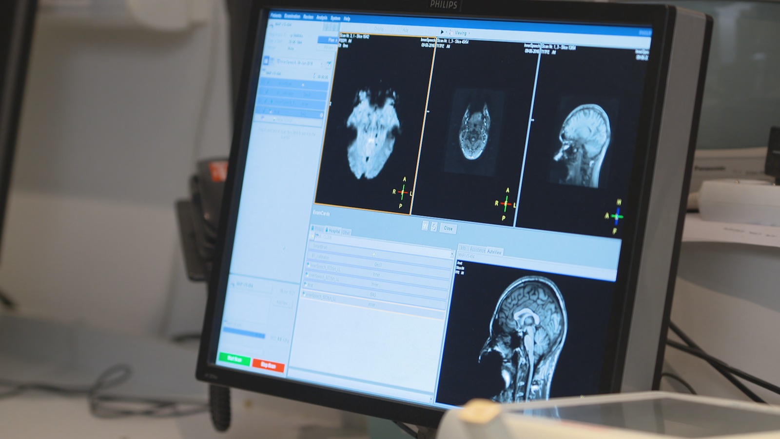 Les chercheurs analysent l'activité cérébrale des participants à l'aide de l'imagerie par résonance magnétique fonctionnelle. Les chercheurs analysent l'activité cérébrale des participants à l'aide de l'imagerie par résonance magnétique fonctionnelle.