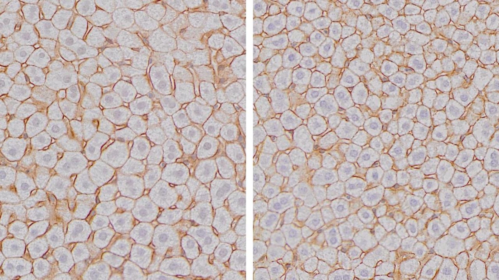 Chez la souris, la taille des cellules hépatocytes atteint son maximum à la fin de la nuit (droite) et son minimum à la fin de la journée (gauche). Chez la souris, la taille des cellules hépatocytes atteint son maximum à la fin de la nuit (droite) et son minimum à la fin de la journée (gauche).