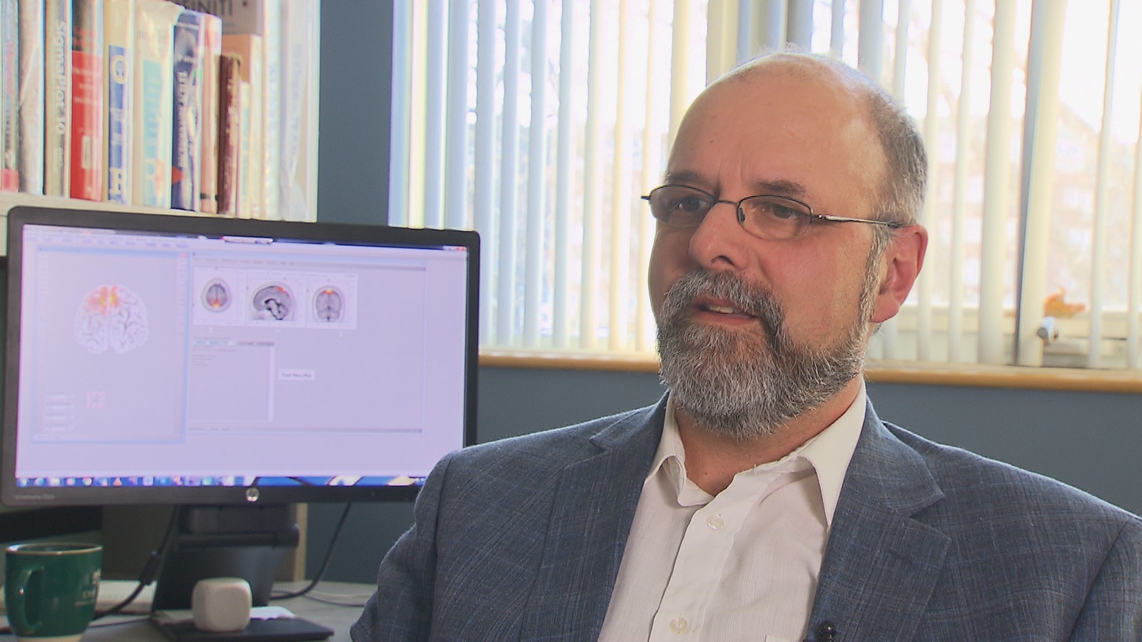 Le professeur en psychiatrie à l'Université de Montréal et spécialiste du syndrome de Gilles de la Tourette, Marc Lavoie. Le professeur en psychiatrie à l'Université de Montréal et spécialiste du syndrome de Gilles de la Tourette, Marc Lavoie.