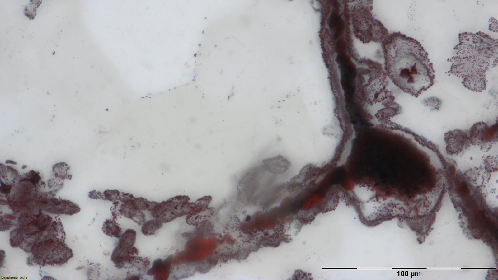 Les restes de micro-organismes sous forme de minuscules filaments découverts dans la ceinture de roches vertes Nuvvuagittuq, dans le nord du Québec. Les restes de micro-organismes sous forme de minuscules filaments découverts dans la ceinture de roches vertes Nuvvuagittuq, dans le nord du Québec.