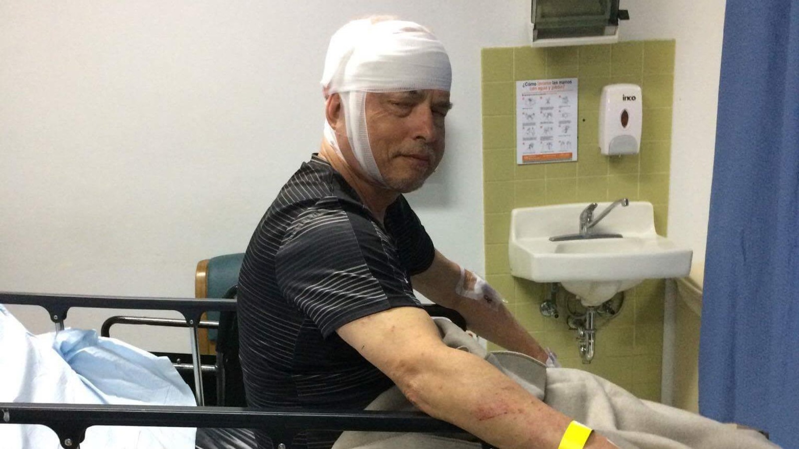 Claude McCann a subi de multiples fractures au crâne et des lacérations lorsque l'embarcation à l'intérieur de laquelle il se trouvait avec sa famille a été fauchée par un autre bateau, à Porto Rico. Claude McCann a subi de multiples fractures au crâne et des lacérations lorsque l'embarcation à l'intérieur de laquelle il se trouvait avec sa famille a été fauchée par un autre bateau, à Porto Rico.