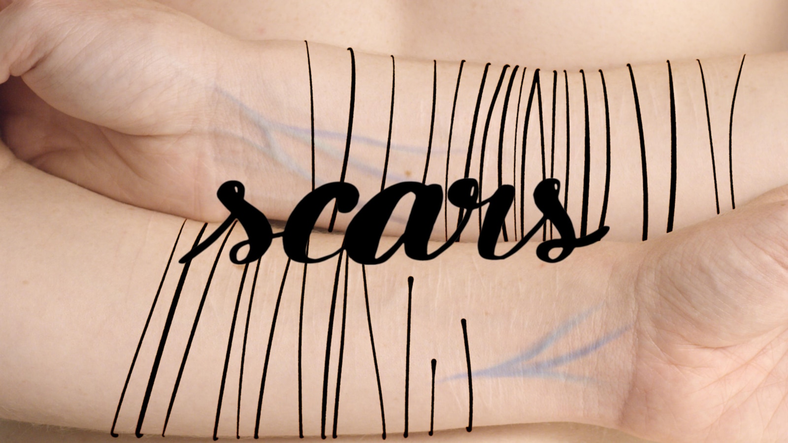 L'affiche du film montrant le titre Scars et des bras.