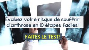 Un médecin tient entre ses mains des photographies par rayons X.
