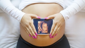 Une femme enceinte tient sur son ventre rebondi une image résultant d'une échographie en 3D