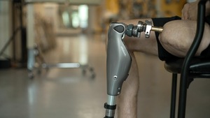 prothèse posé dans une jambe amputée.