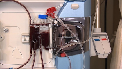 Un appareil d'hémodialyse