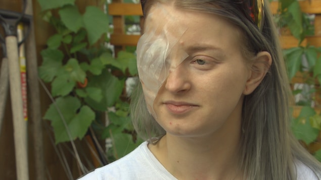 La victime Brittney Thomas-Ljungberg avec un pansement sur son oeil droit