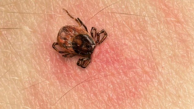 Chronique santé avec la Dre Véronique Savoie : la maladie de Lyme