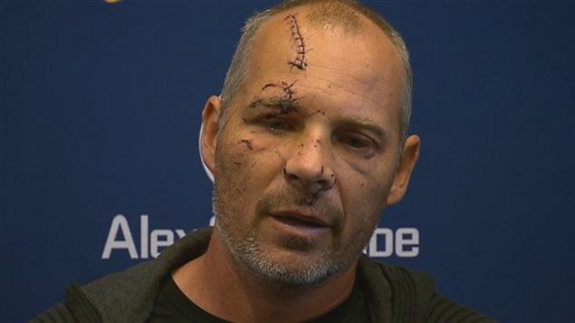 Michel Laplante, après l'accident d'hélicoptère Michel Laplante, après l'accident d'hélicoptère