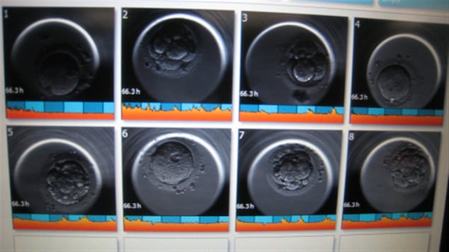 Des embryons vus au microscope Des embryons vus au microscope