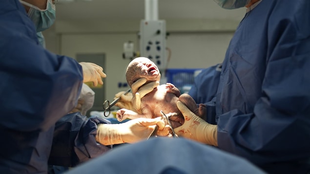 Un bébé vient de naître. Il est dans les mains des médecins