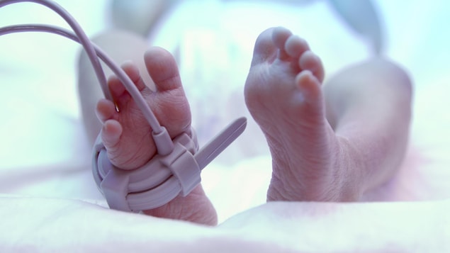 Un bébé prématuré