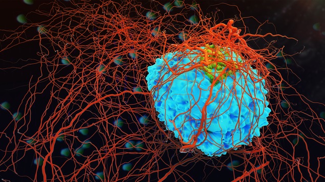 Des cellules cancéreuses