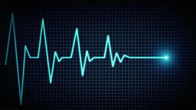 Une image représentant un électrocardiogramme qui se termine en une ligne droite représentant la mort.