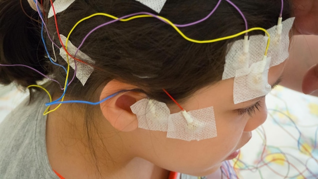 Une femme avec des électrodes multicolores sur la tête.