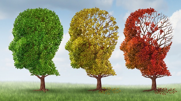 Trois arbres qui perdent des feuilles.