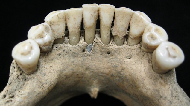 Dentition du bas d'un squelette.