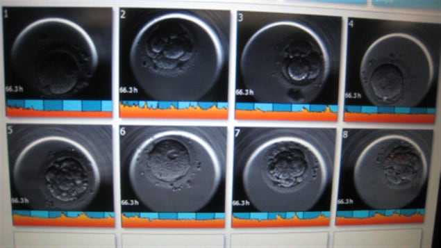 Des embryons vus au microscope